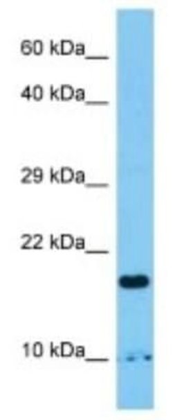 RWDD1 Rabbit anti-Human, Polyclonal, Novus Biologicals 100 &mu;g; Unconjugated:Antibodies,